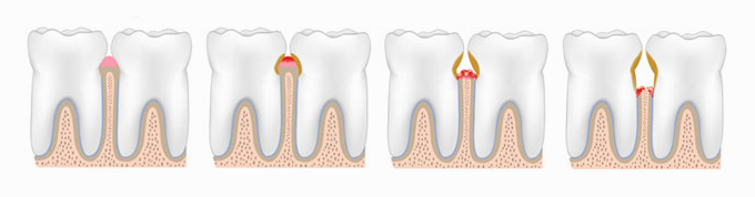 periodontoloji-1